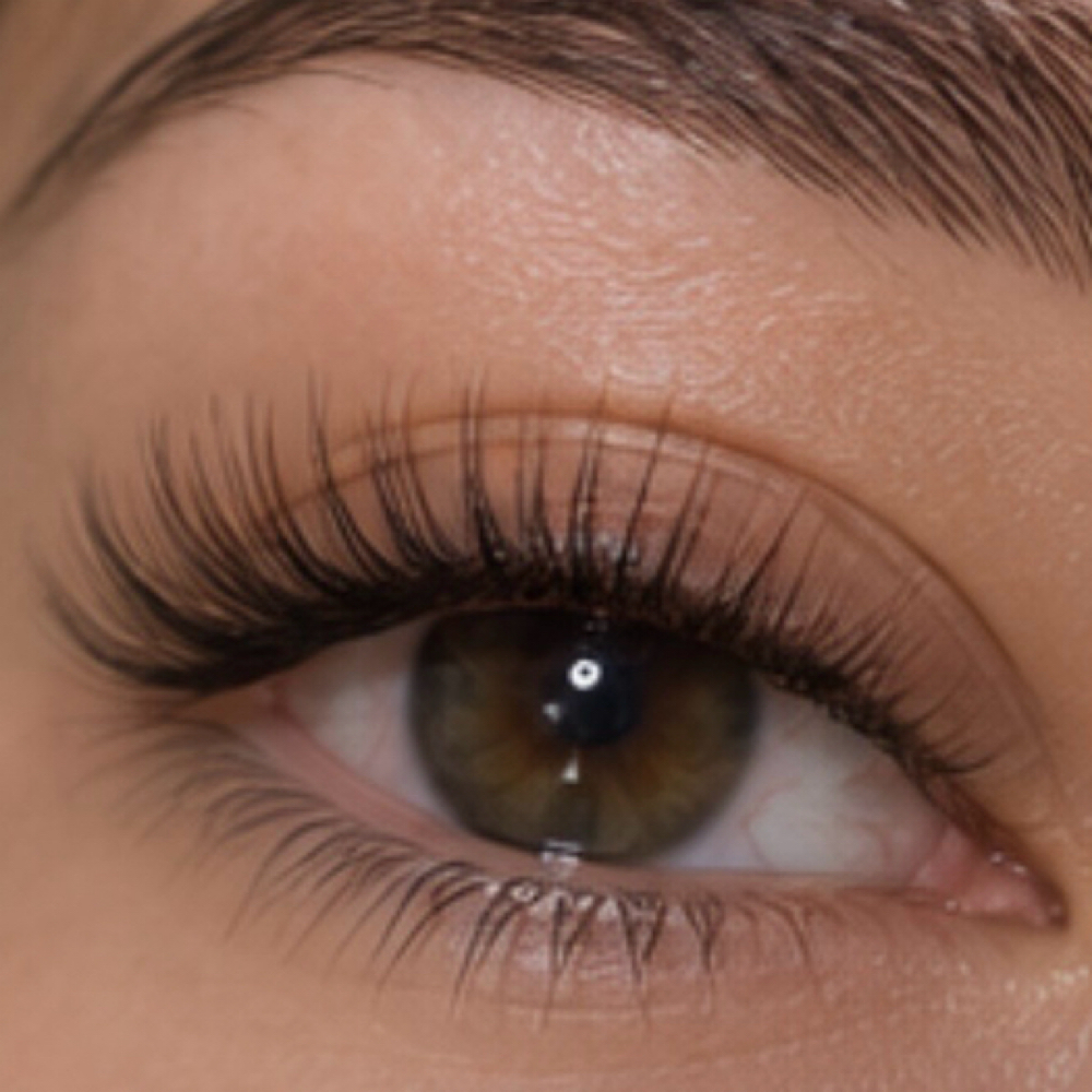 Classic Fill at Luma Esthetics in mechanicsburg, PA
