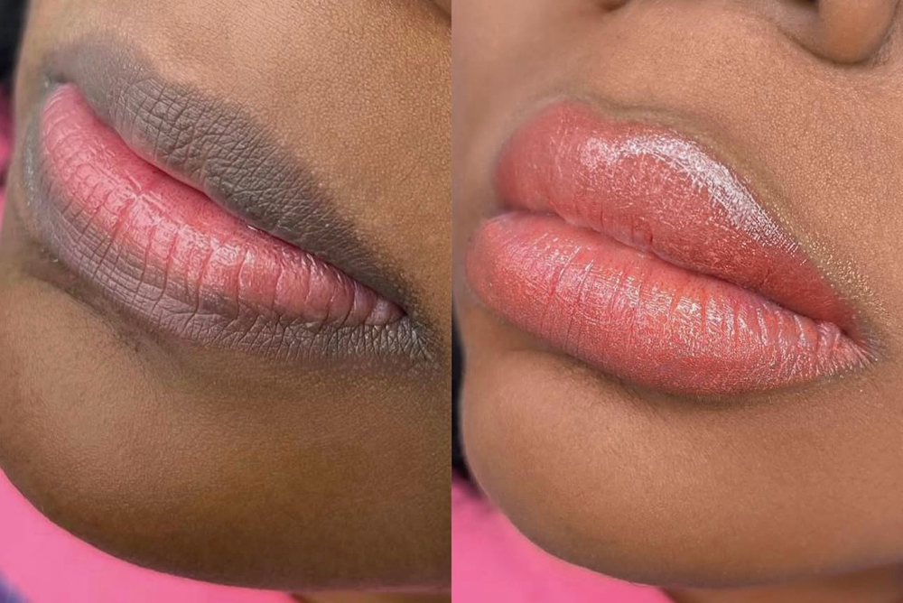 Lip Neutralization