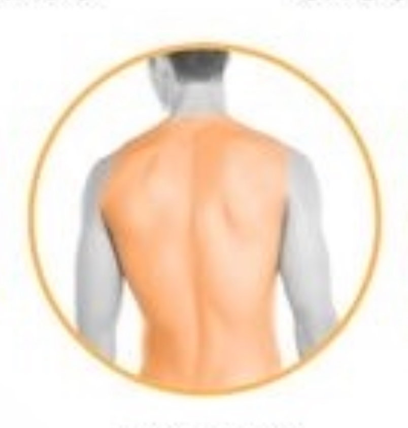 FULL BACK Laser Hair Removal