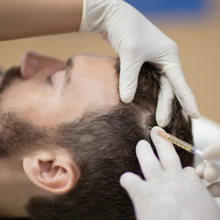 PRP Hair restoration