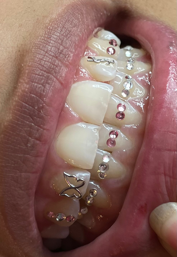 Tooth Gems 8+ Gems