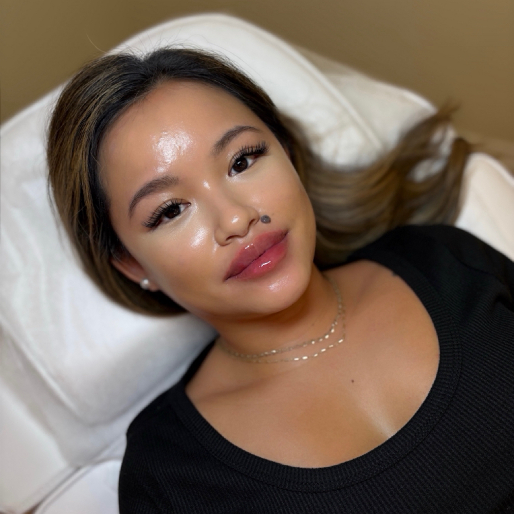 ✨MODEL PROMO BOTOX & LIPS✨ at The Skin Room Med Spa in Marshall, TX