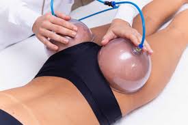 Vacuum Glutes RF Therapy