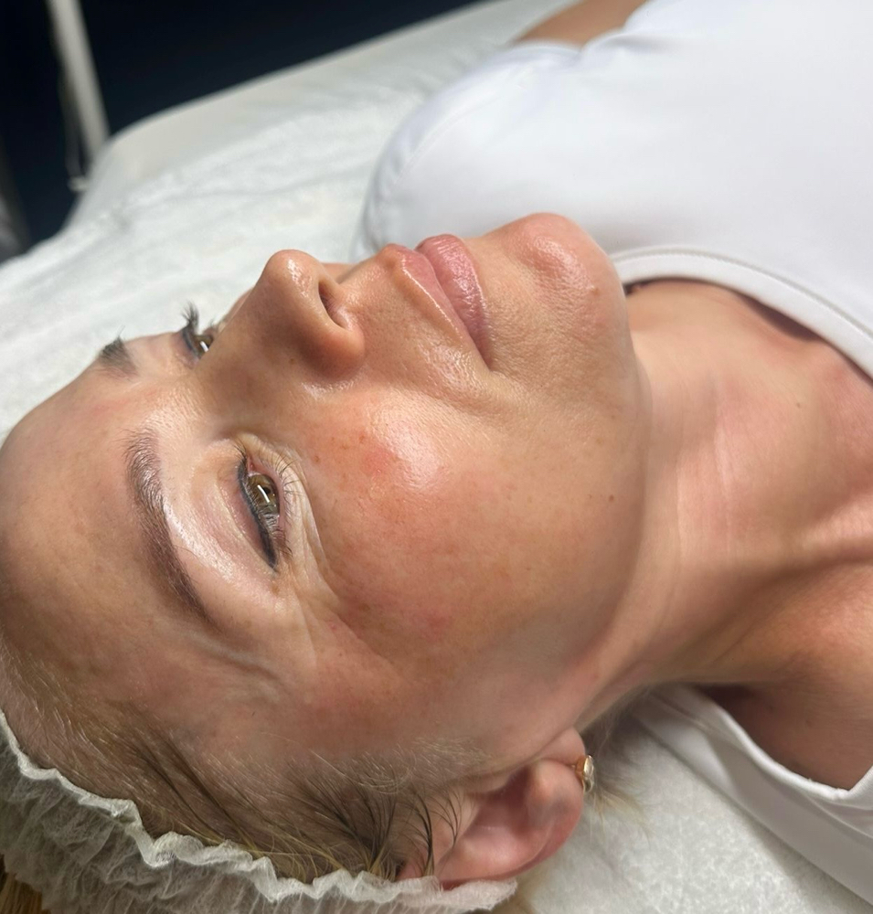 Anti-Wrinkle Tri-Retinol Facial