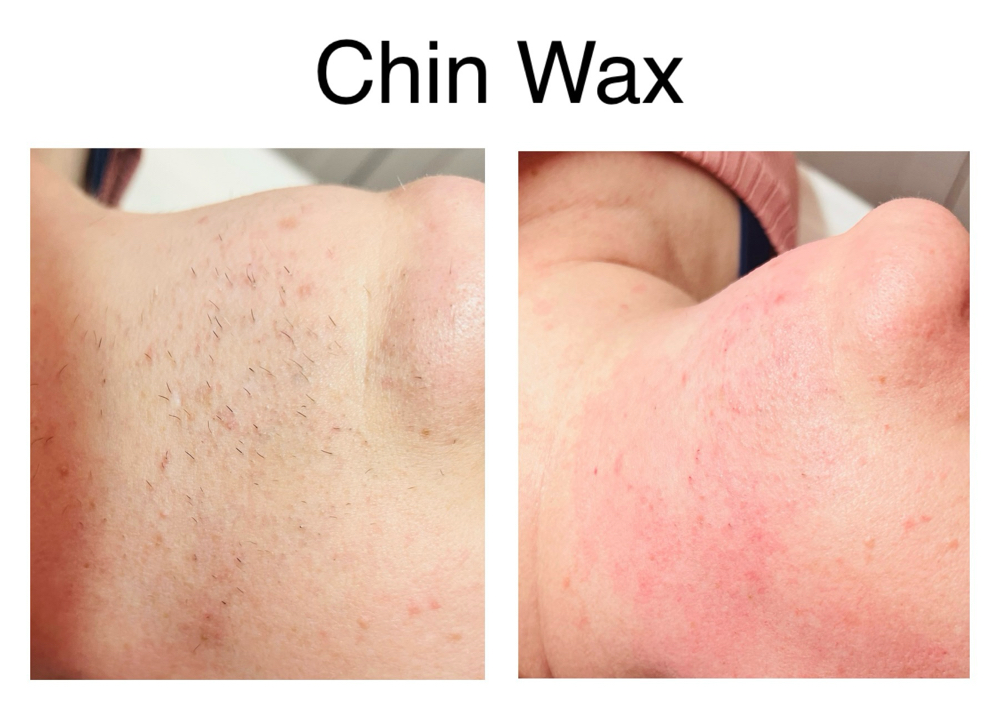 Chin