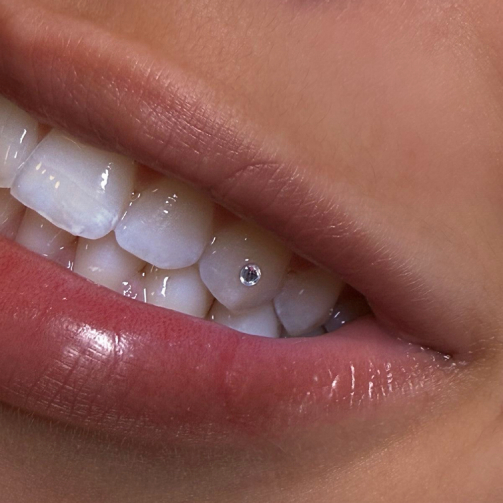 Signature Tooth Gems at Pearly N White Smiles in Salem, OR