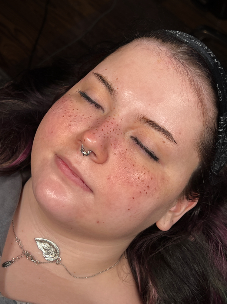 Freckle Tattoo