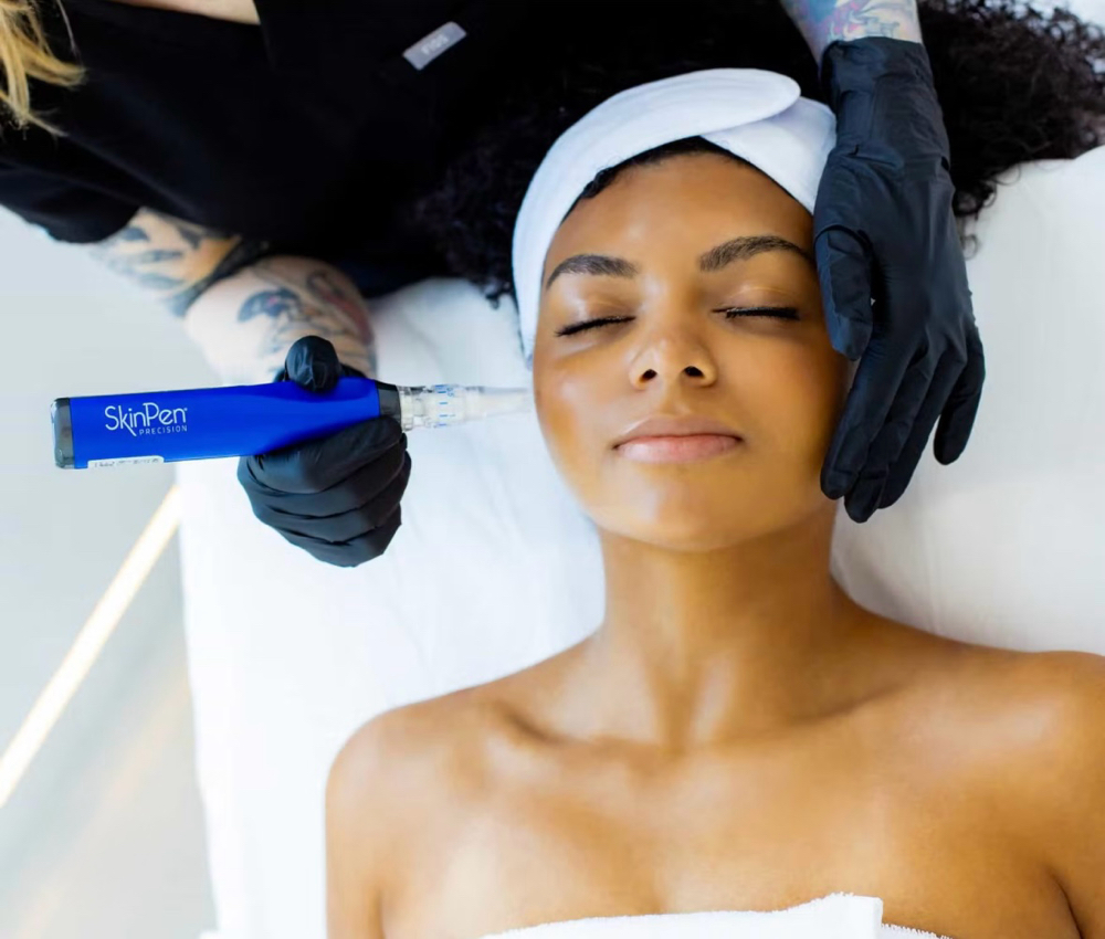 Microneedling