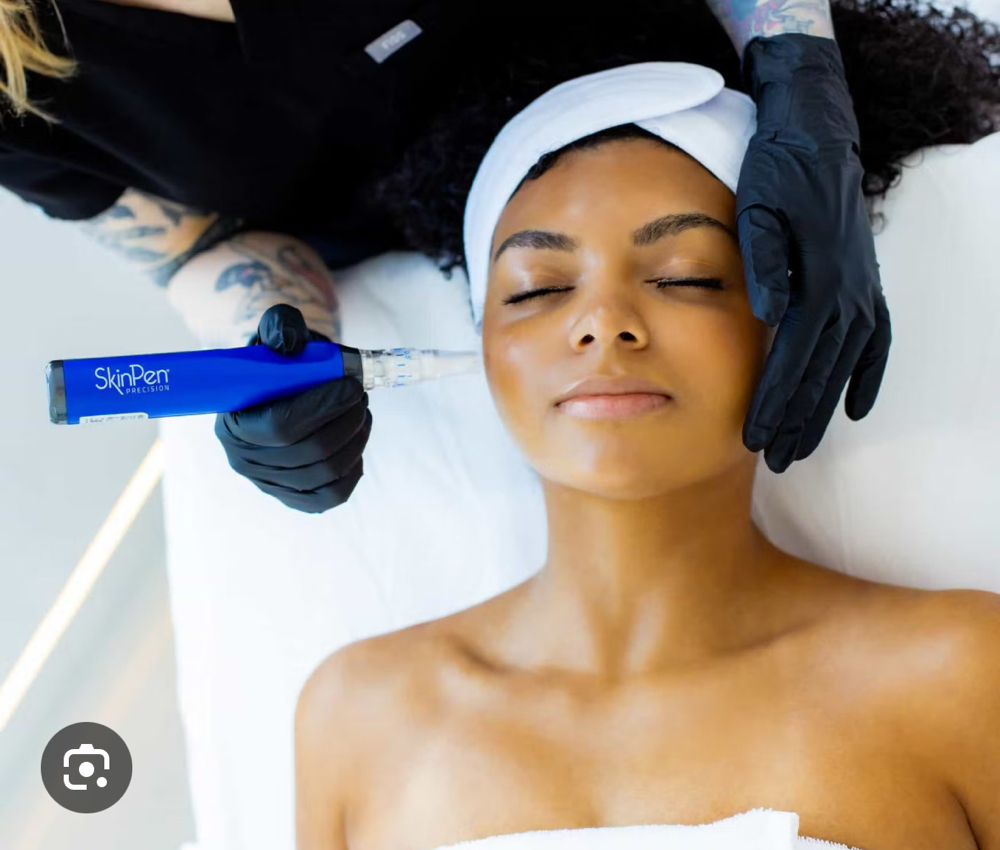 Microneedling
