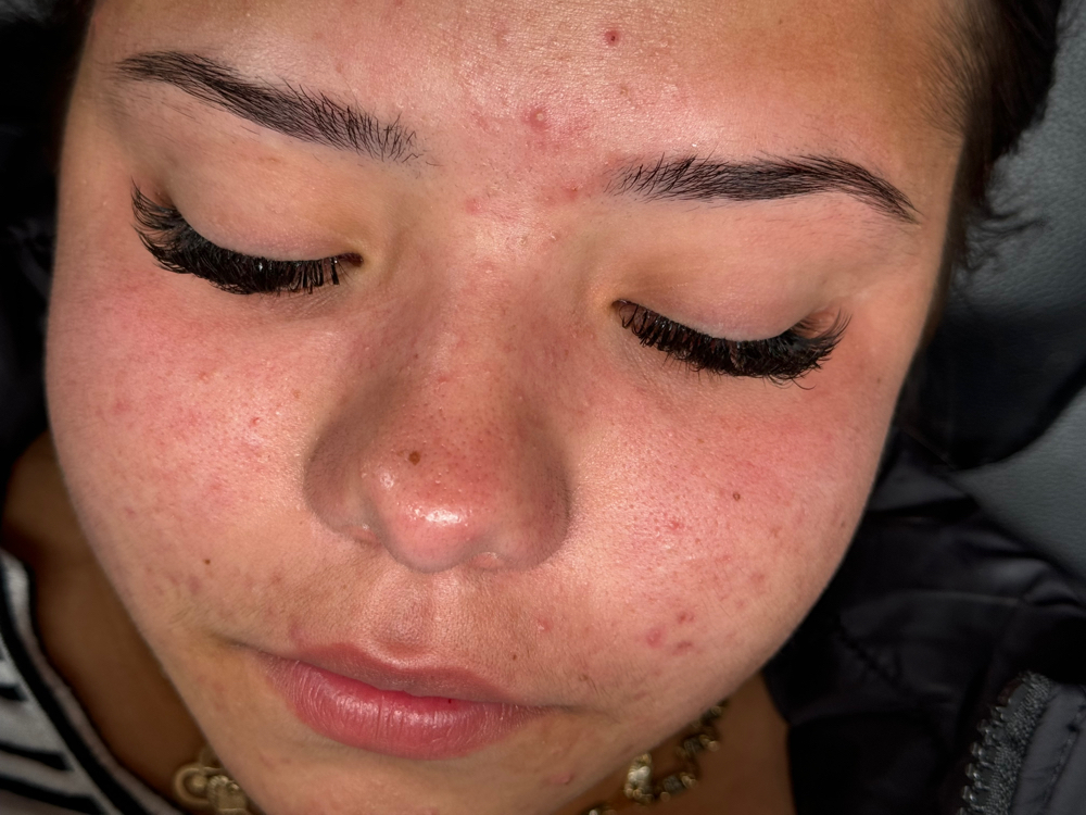 Volume Lash Set