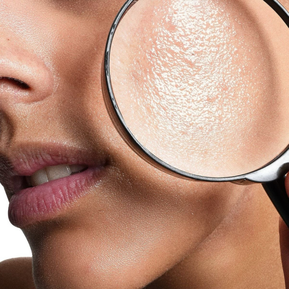 Acne Facial at Copper 22 Salon in Mineral Wells, WV