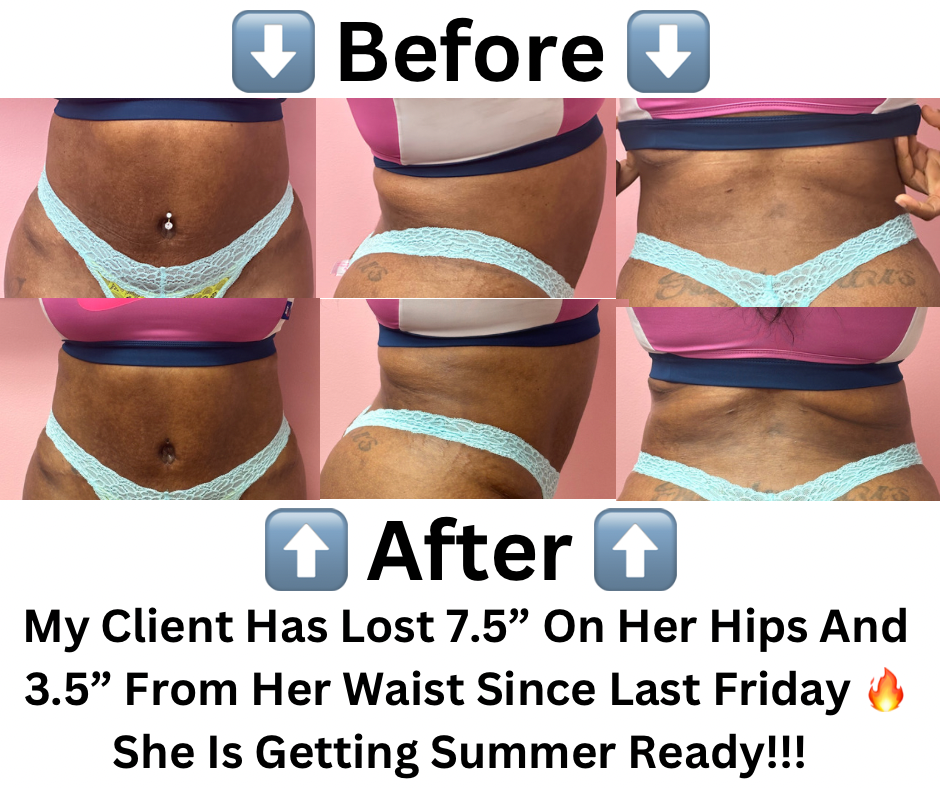 Body Sculpting- Stomach at Get Waisted By MJ in Marietta, GA