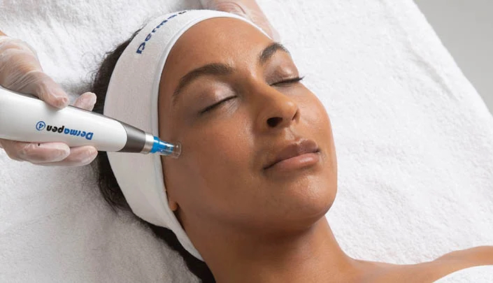 Microneedling Facial