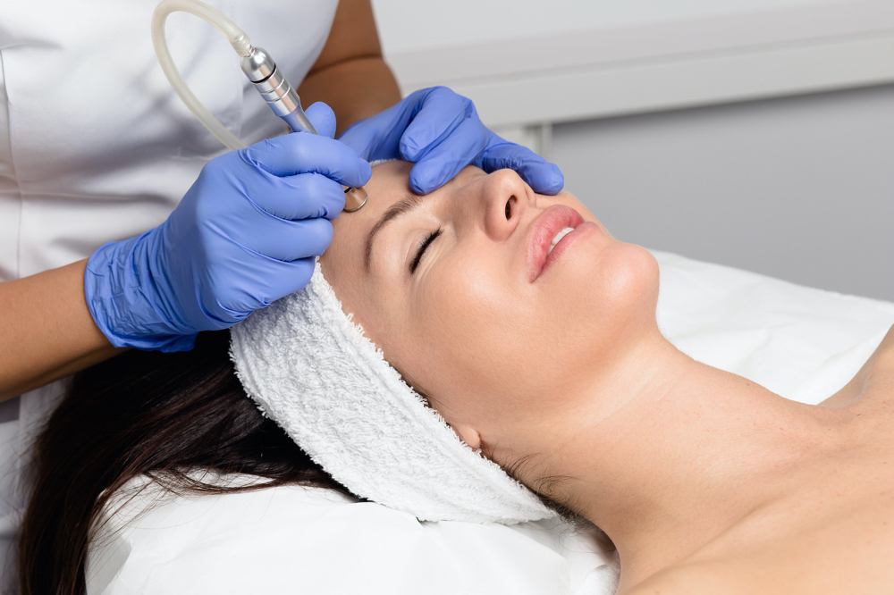 Microdermabrasion Facial