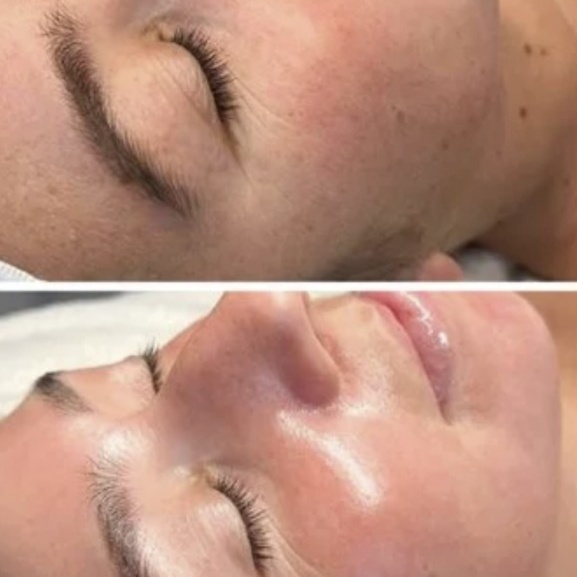 Level 3  Facial – 75 Minutes