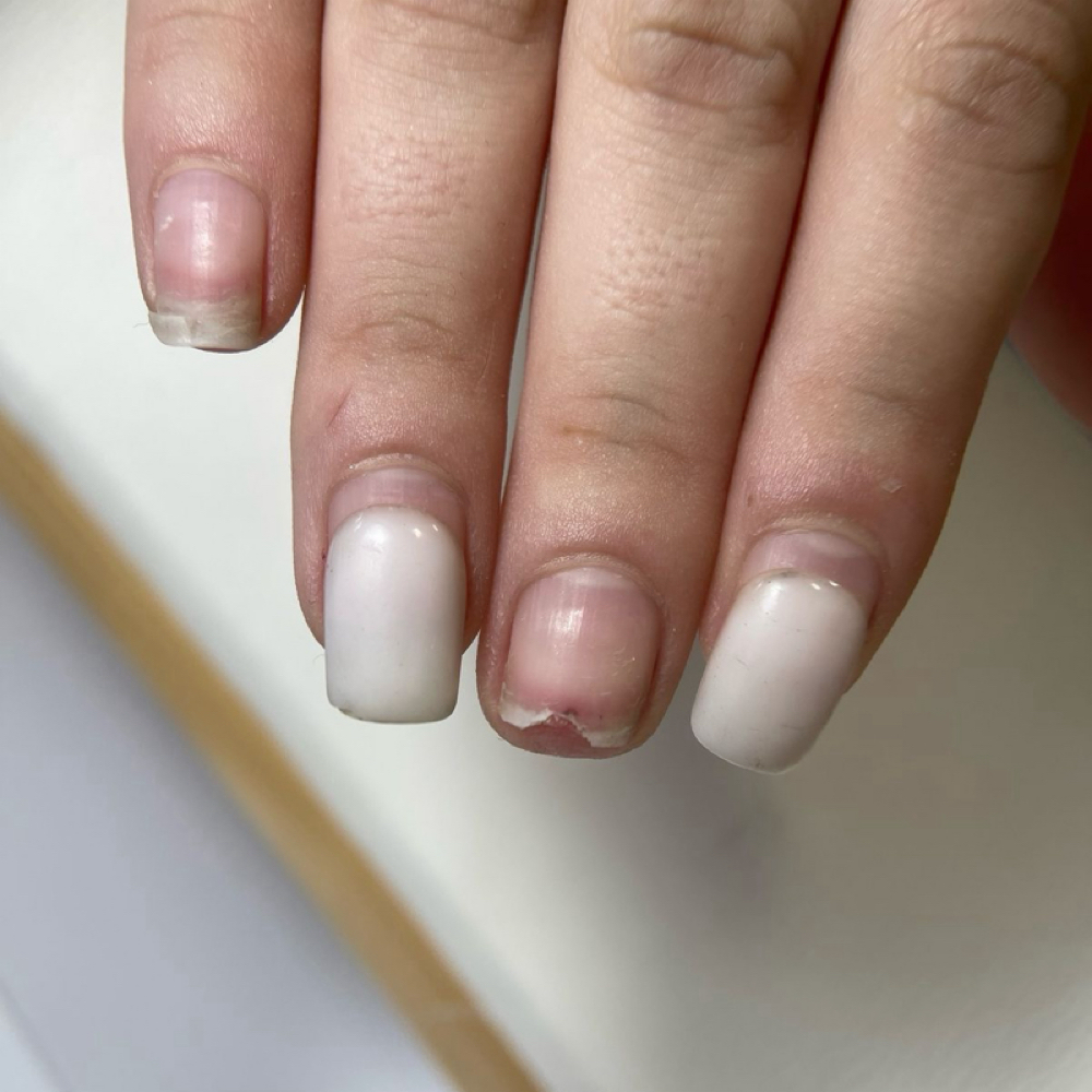 Broken Nail Repair at Synergy Skin And Nails in Wasilla, AK