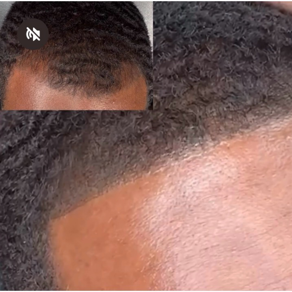 SCALP PIGMENTATION SERVICE at Xclusive Beauty N' Brows in Houston, TX