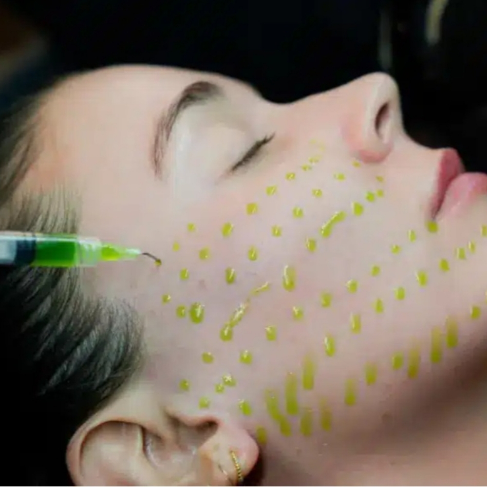BioRepeel at BeautyGlo in San Antonio, TX