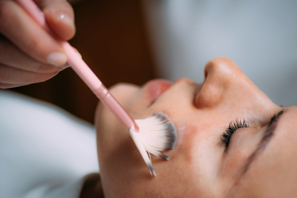 Targeted Chemical Peel