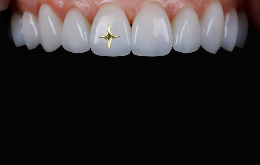 18k Gold Charm