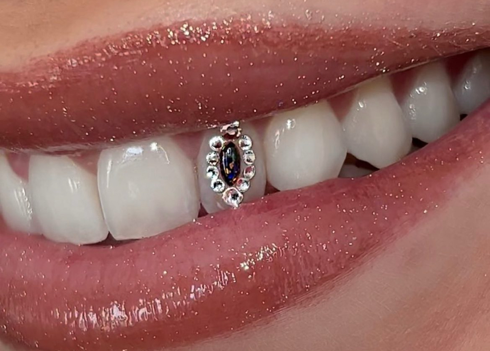 Remove Tooth Gem  💎