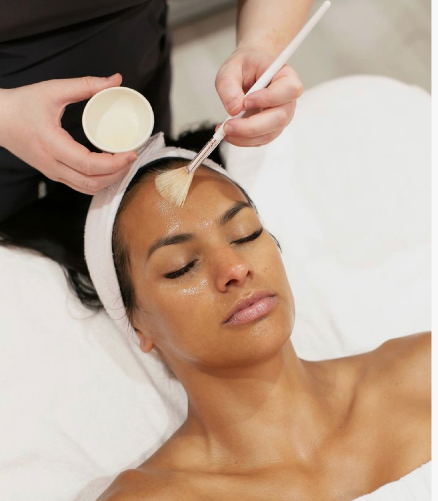 Chemical Peel