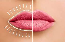 Lip Flip at Echelon Beauty and Glam Bar in Dallas, TX