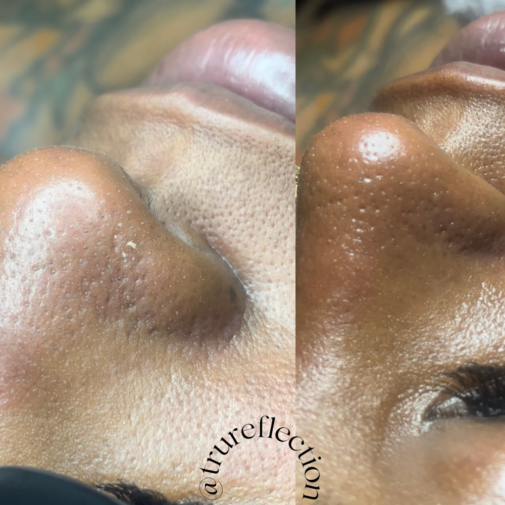 Facial Consultion