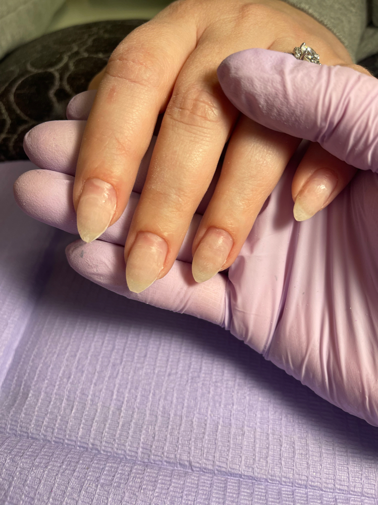 Acrylic Fill