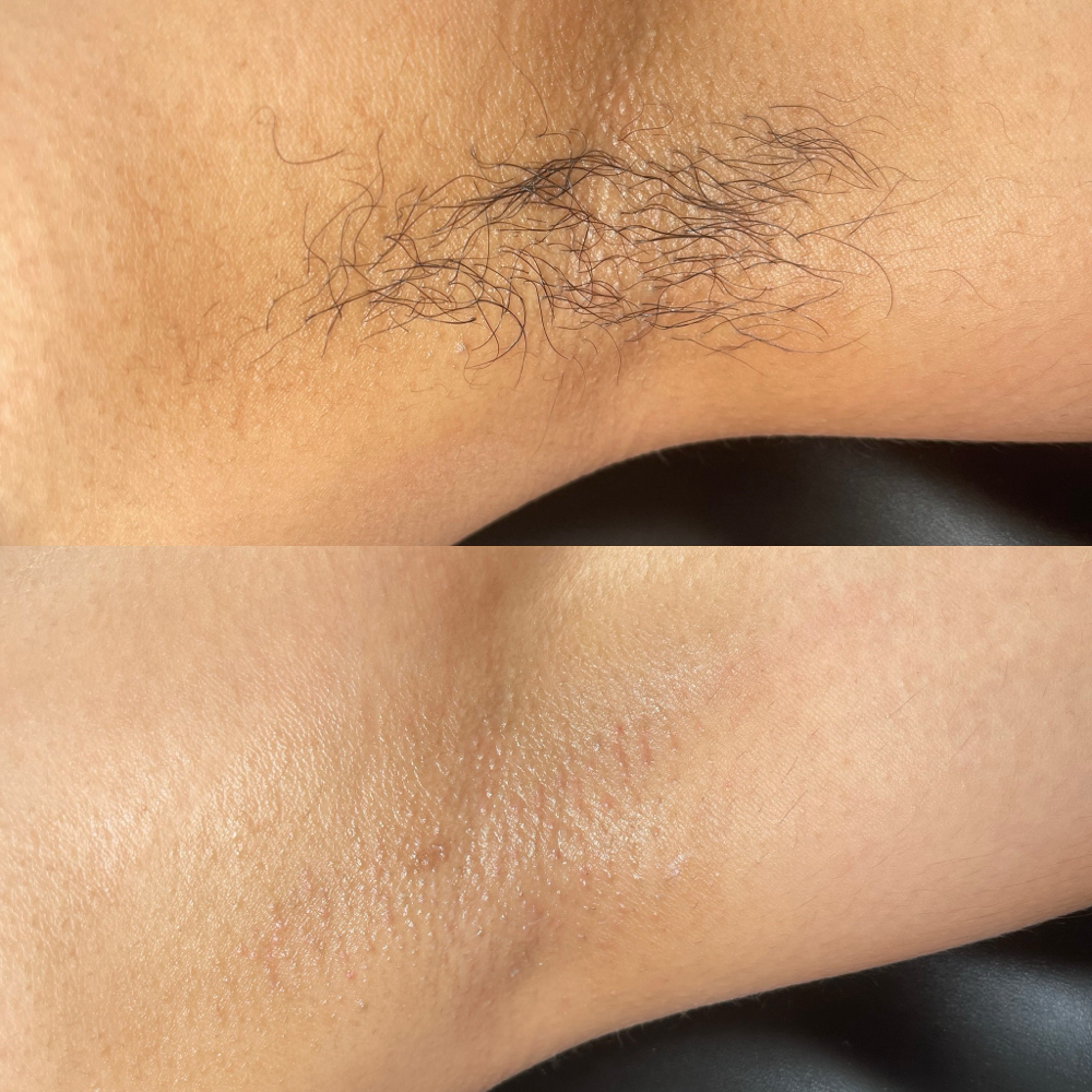 Under Arm Wax