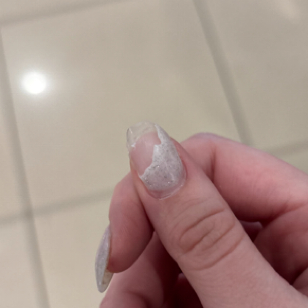 Nail Fix (before 2 Weeks) at Coastal Nail Co. in Belville, NC