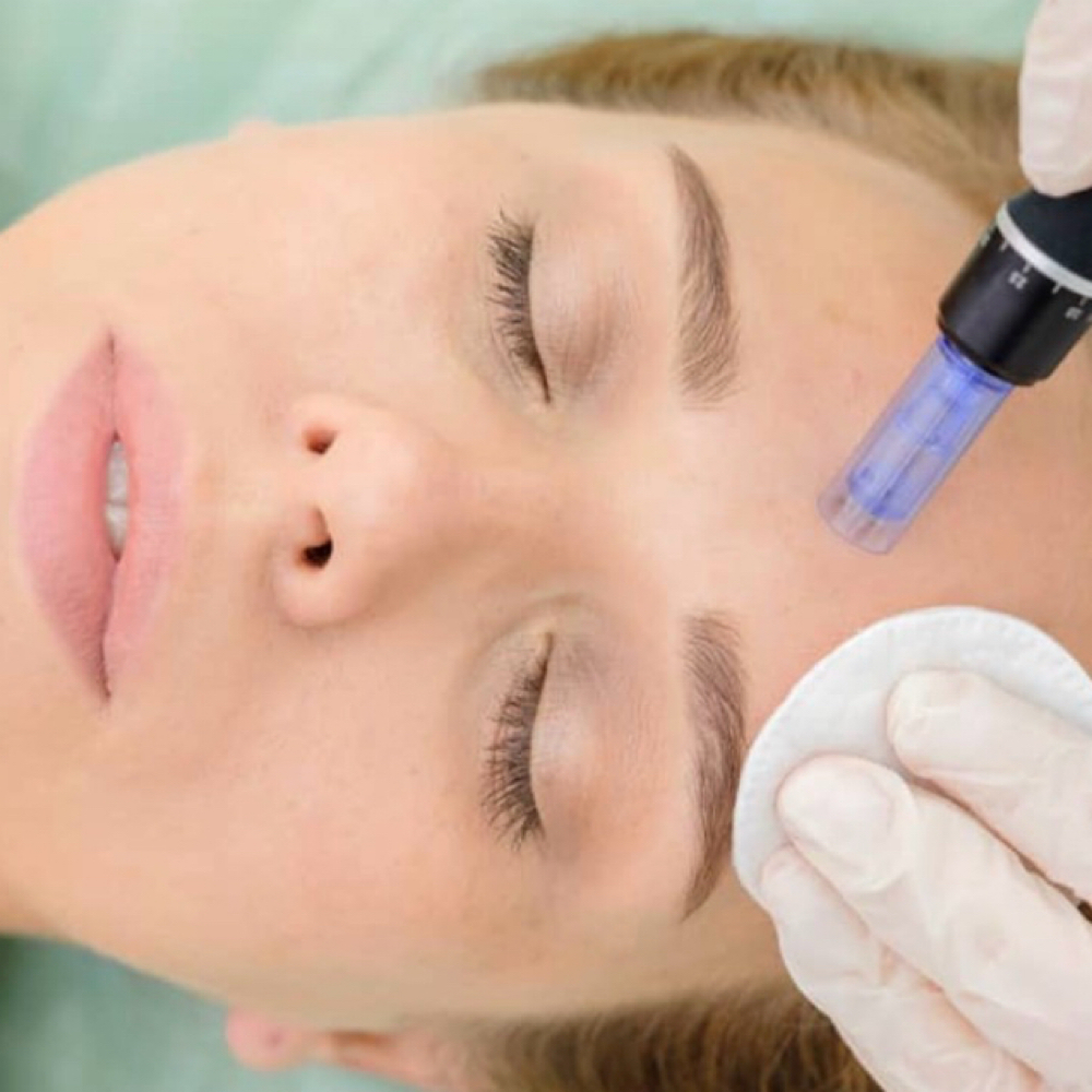 Havenly Needling Oasis at The Havynn For Beauty in Colorado Springs, CO
