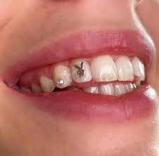 Additional Tooth Gemz