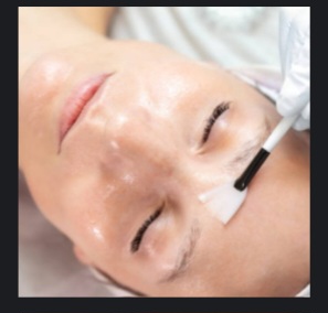 Chemical Peel Add-on To a Facial