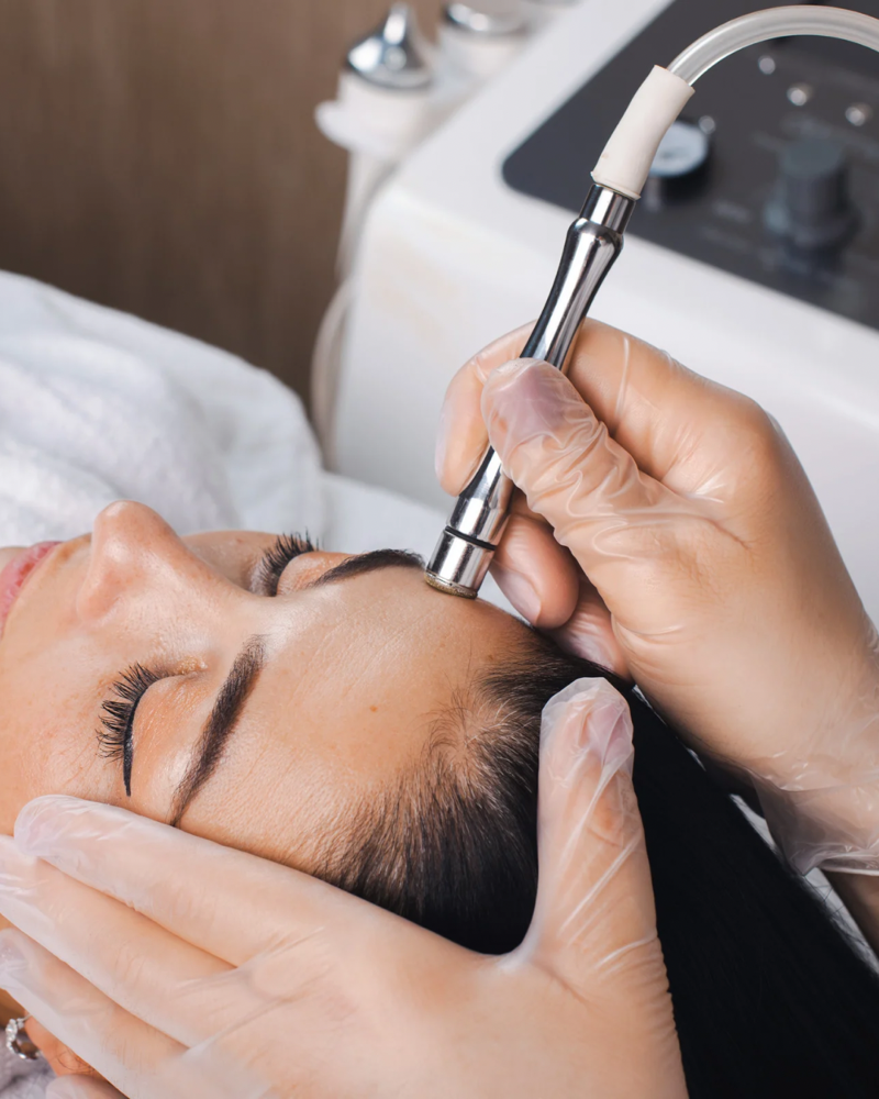 Microdermabrasion Face Treatment (50 mins)