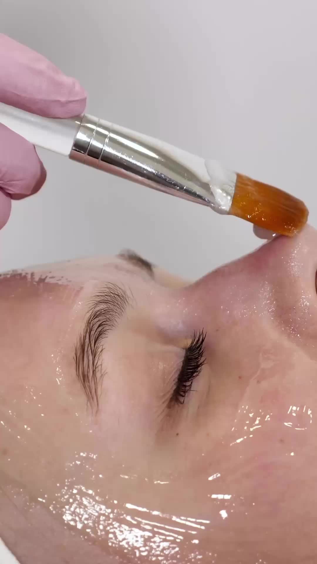 Custom Facial with Chemical peel