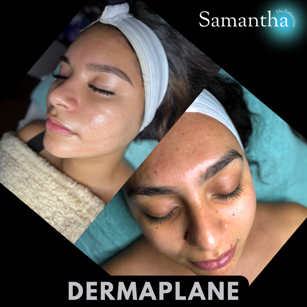 Dermaplane | Add On