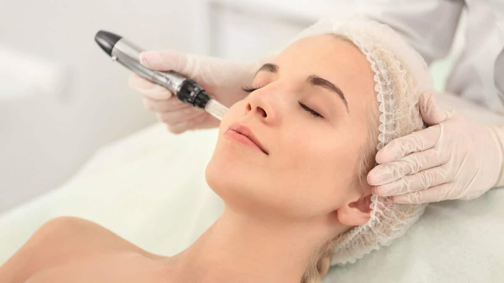 Microneedling