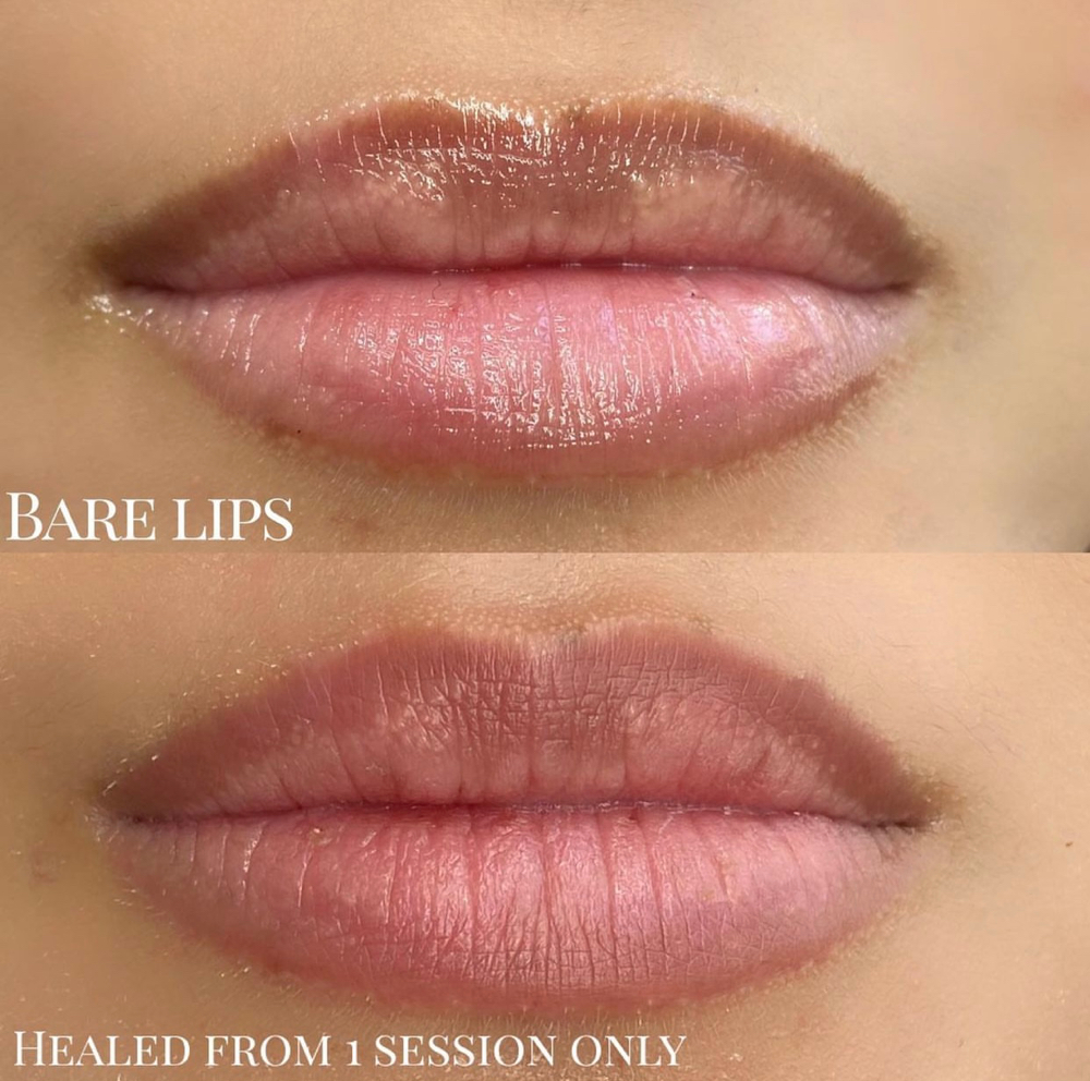 Dark Lip Neautralization