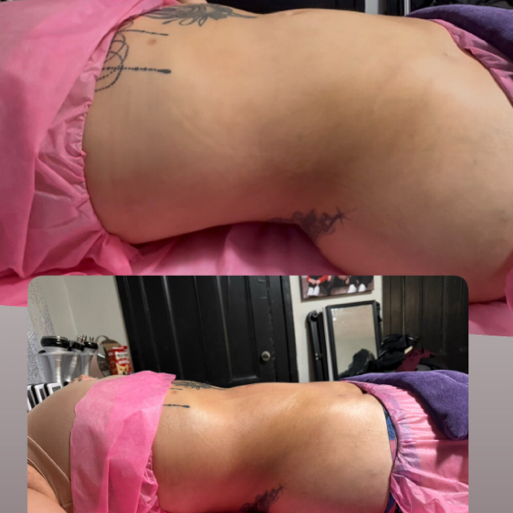 Masaje lymphatico Paquete De 15 Ses at Namaste Beauty & Body in Geneva, NY
