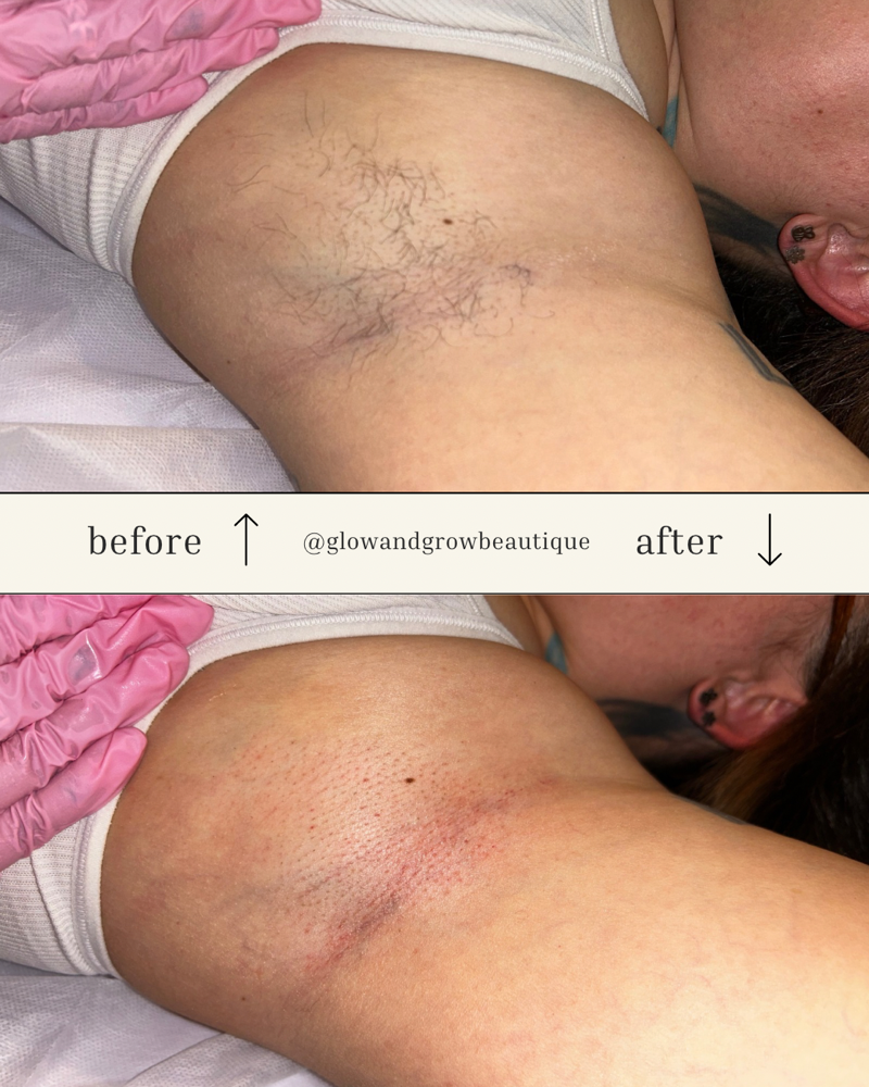 Underarm Wax