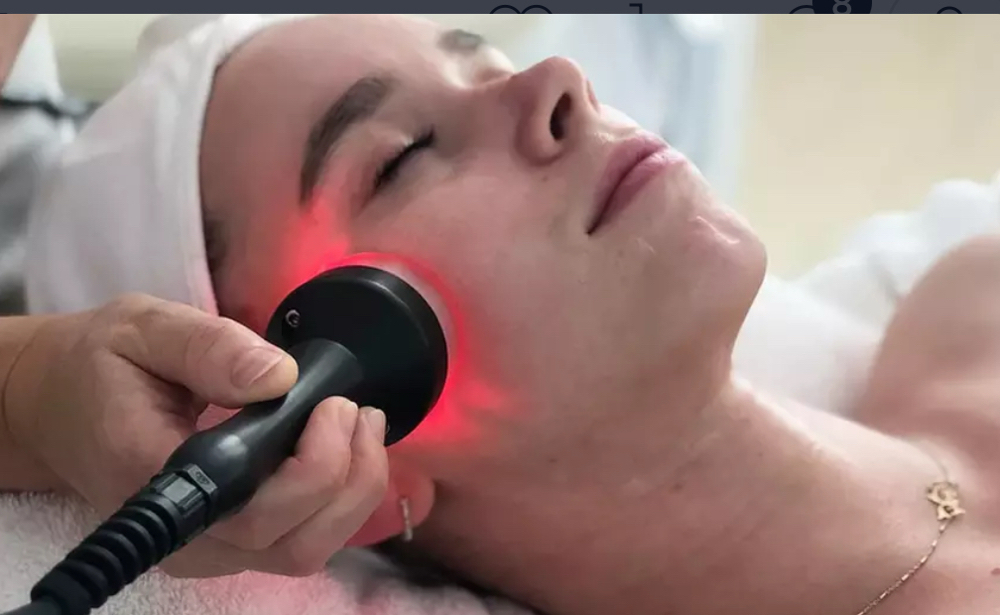 Radiofrequency Face Treatment at DVASH AESTHETICS in Harlingen, TX