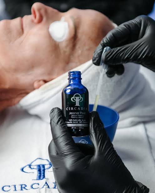 Lactic Acid Peel Facial