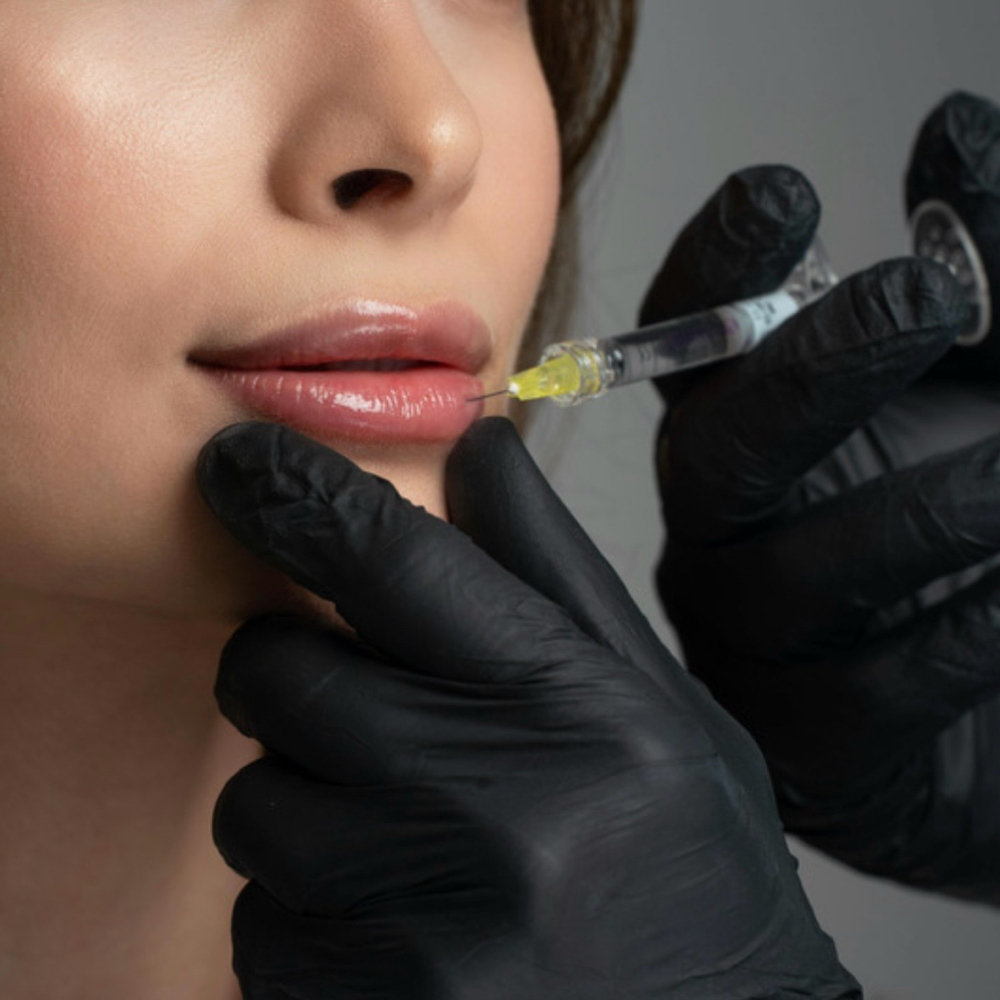 1/2 Syringe Of Filler at Glow & Go Aesthetics in St Albans, WV