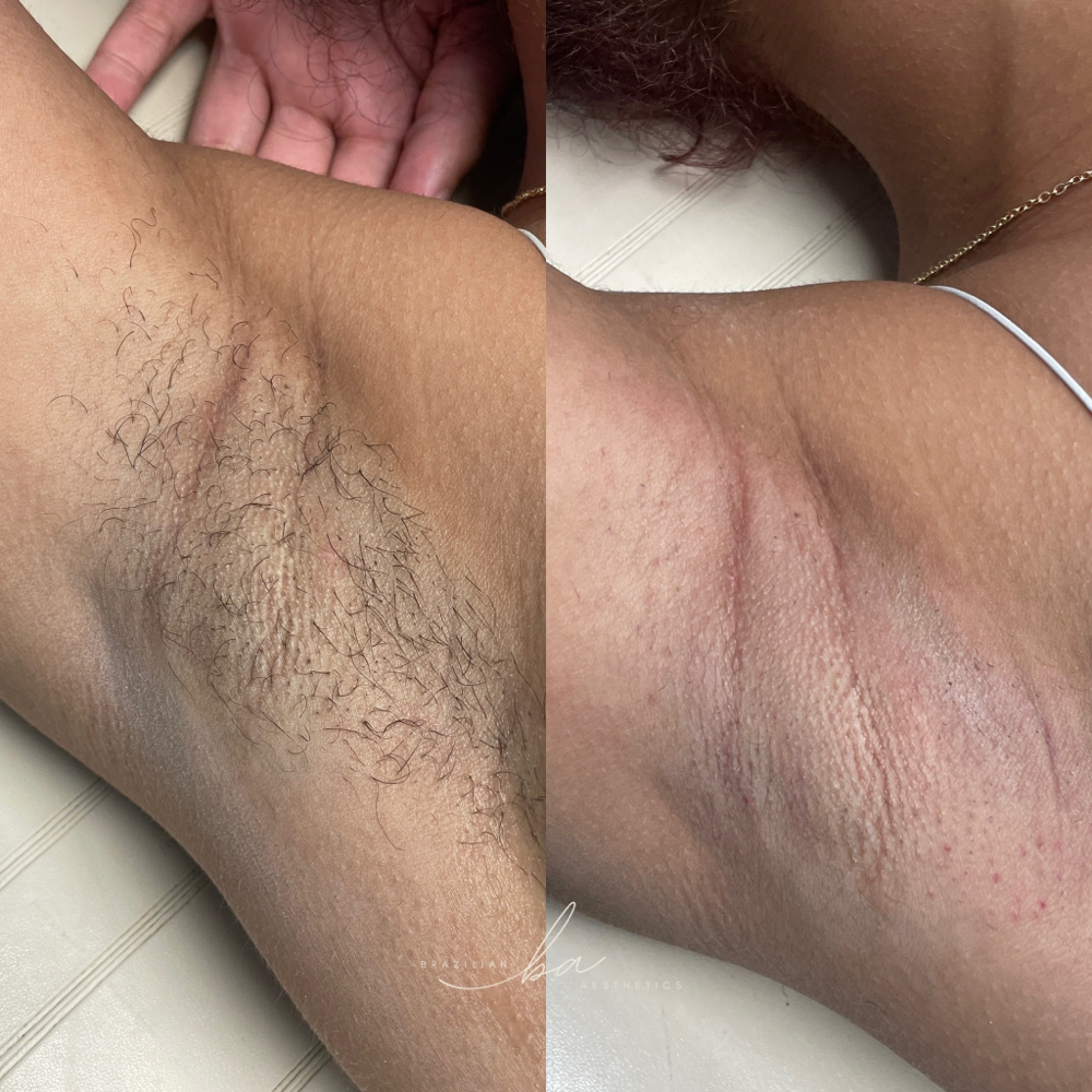 Underarms Wax