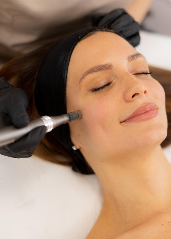 MICRONEEDLING at Zentique Aesthetics in Las Vegas, NV