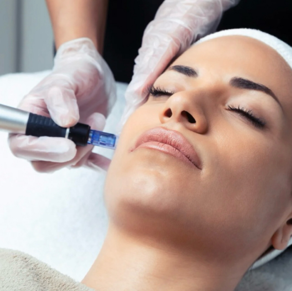 MICRONEEDLING at Zentique Aesthetics in Las Vegas, NV