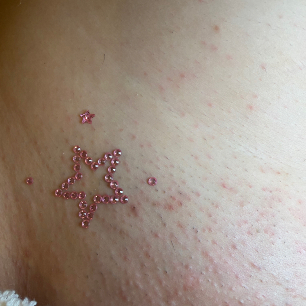 Bikin Wax at Icygirlesthetics in Canoga Park, CA