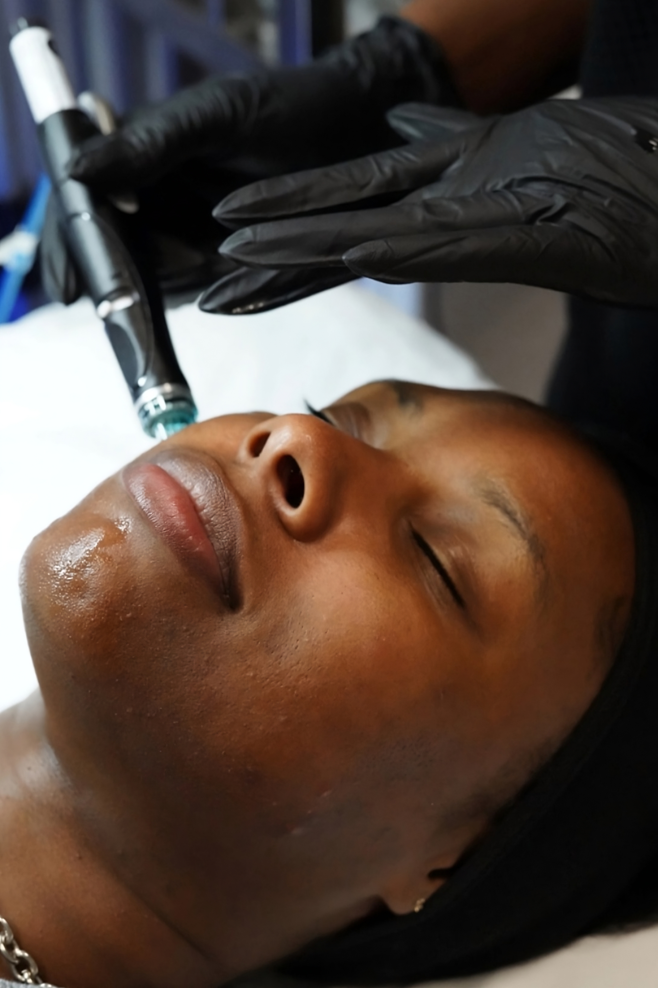 HydraFacial