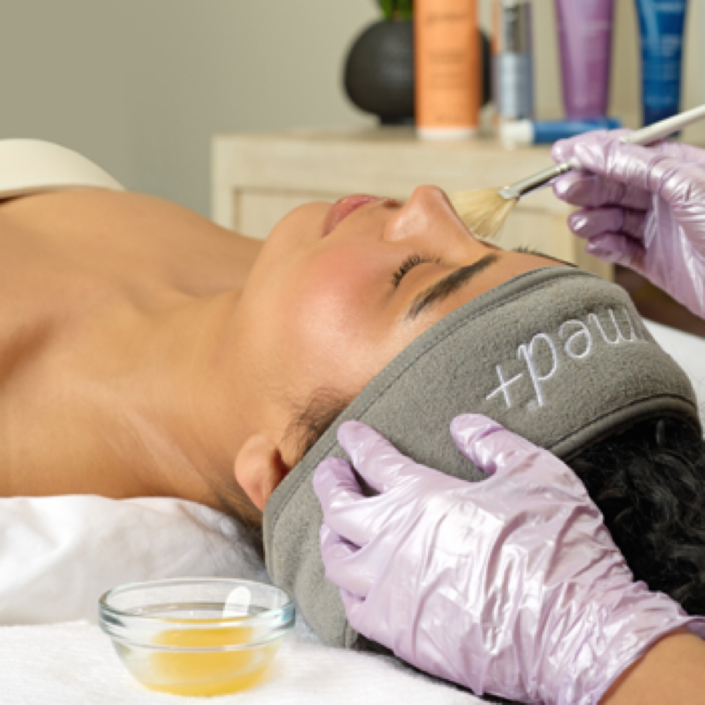 Chemical Peels at Esthaelis Skin in Riverside, CA